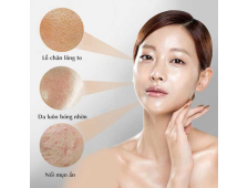 Tại Sao Da Dầu Vẫn Cần Phải Cấp Nước Để Khỏe Đẹp Từ Bên Trong?