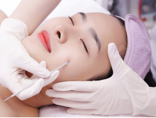 Tư Vấn Các Phương Pháp Điều Trị Mụn Hiệu Quả Tại Spa Cho Từng Loại Da