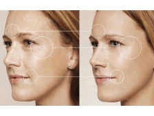 Quy trình trẻ hóa da mặt bằng phương pháp PRP