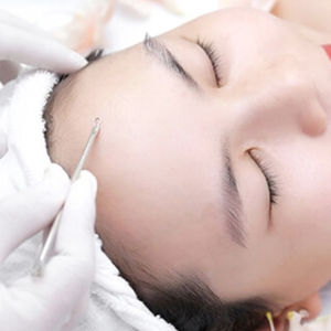 Chăm S&oacute;c Da Xử L&yacute; Nh&acirc;n Mụn