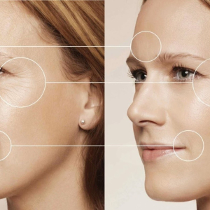 Thanh Lọc Trẻ H&oacute;a Da