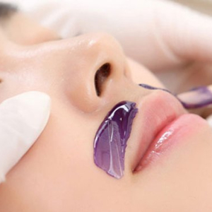 Triệt L&ocirc;ng V&ugrave;ng M&eacute;p