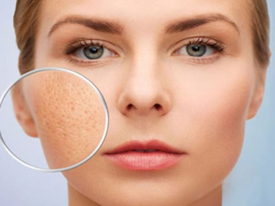 chăm s&oacute;c da khi ra nắng