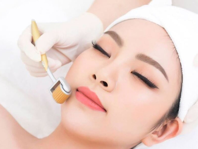 C&aacute;ch chăm s&oacute;c da sau khi lăn kim trẻ h&oacute;a 