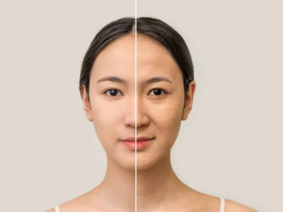 Da Xuống Cấp Nhanh Ch&oacute;ng? 5 Nguy&ecirc;n Nh&acirc;n G&acirc;y L&atilde;o H&oacute;a v&agrave; C&aacute;ch Cứu Nguy Kịp Thời