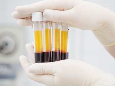 Đ&agrave;o tạo nghề spa kh&oacute;a học l&agrave;m trẻ h&oacute;a da PRP cấp tốc 