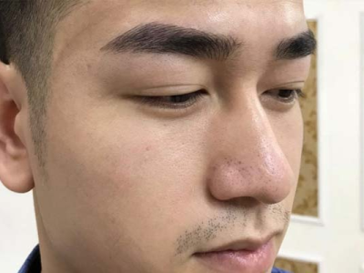 Đi&ecirc;u Khắc Ch&acirc;n M&agrave;y Nam Tại Dĩ An, B&igrave;nh Dương - Giải Ph&aacute;p Ho&agrave;n Hảo Cho Ph&aacute;i Mạnh