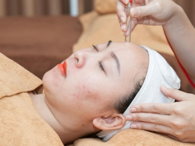 Top 5 C&aacute;c Phương Ph&aacute;p Điều Trị Mụn Hiệu Quả Tại Spa Được Ưa Chuộng Nhất Hiện Nay