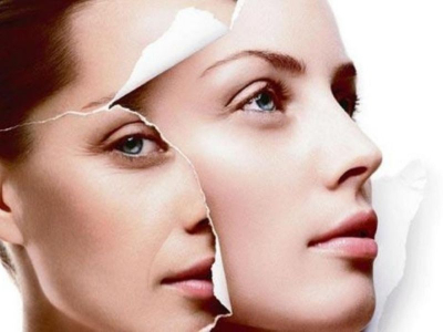 Trẻ h&oacute;a da PRP 3 th&aacute;ng c&oacute; hiệu quả kh&ocirc;ng? Theo d&otilde;i ngay!