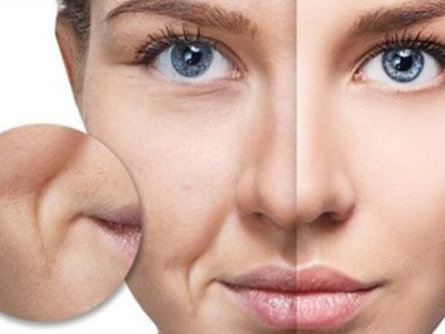 X&oacute;a vết nhăn trẻ h&oacute;a da r&atilde;nh mũi g&ograve; m&aacute;