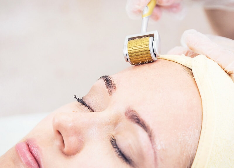 Đối tượng phù hợp lăn kim để trẻ hoá da mặt