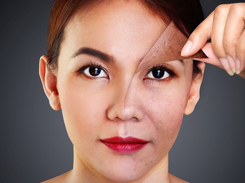 Dùng PRP giúp làn da đẹp hồng hào từ sâu bên trong