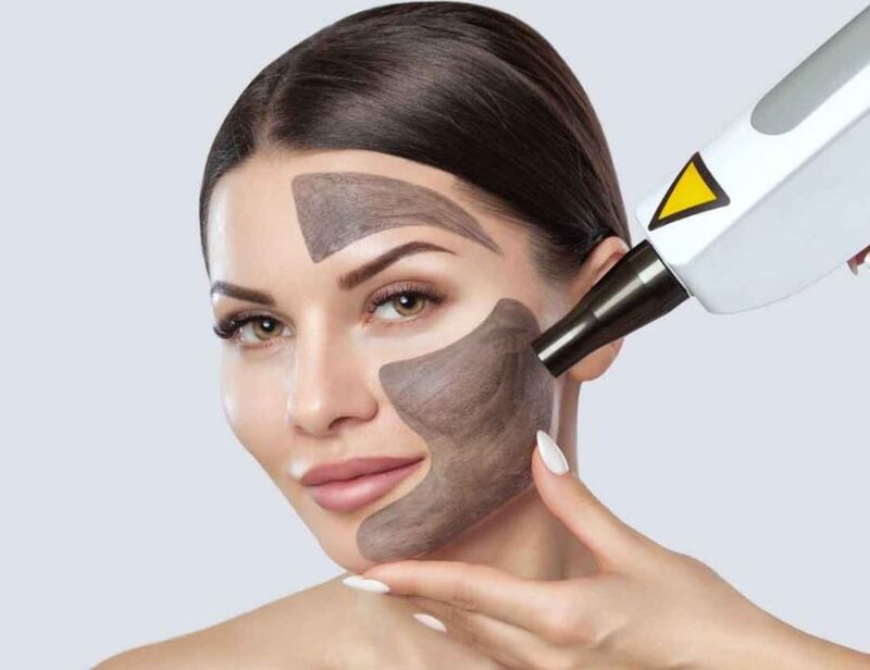 Trẻ hóa da Laser Carbon than hoạt tính tại Dr Tâm