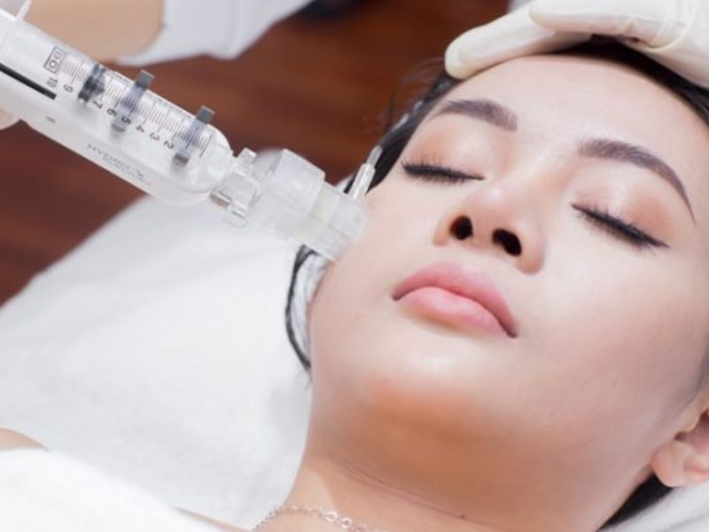 Trẻ hoá da căng bóng